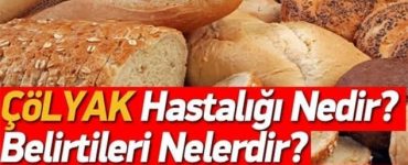 Glutensiz besinler